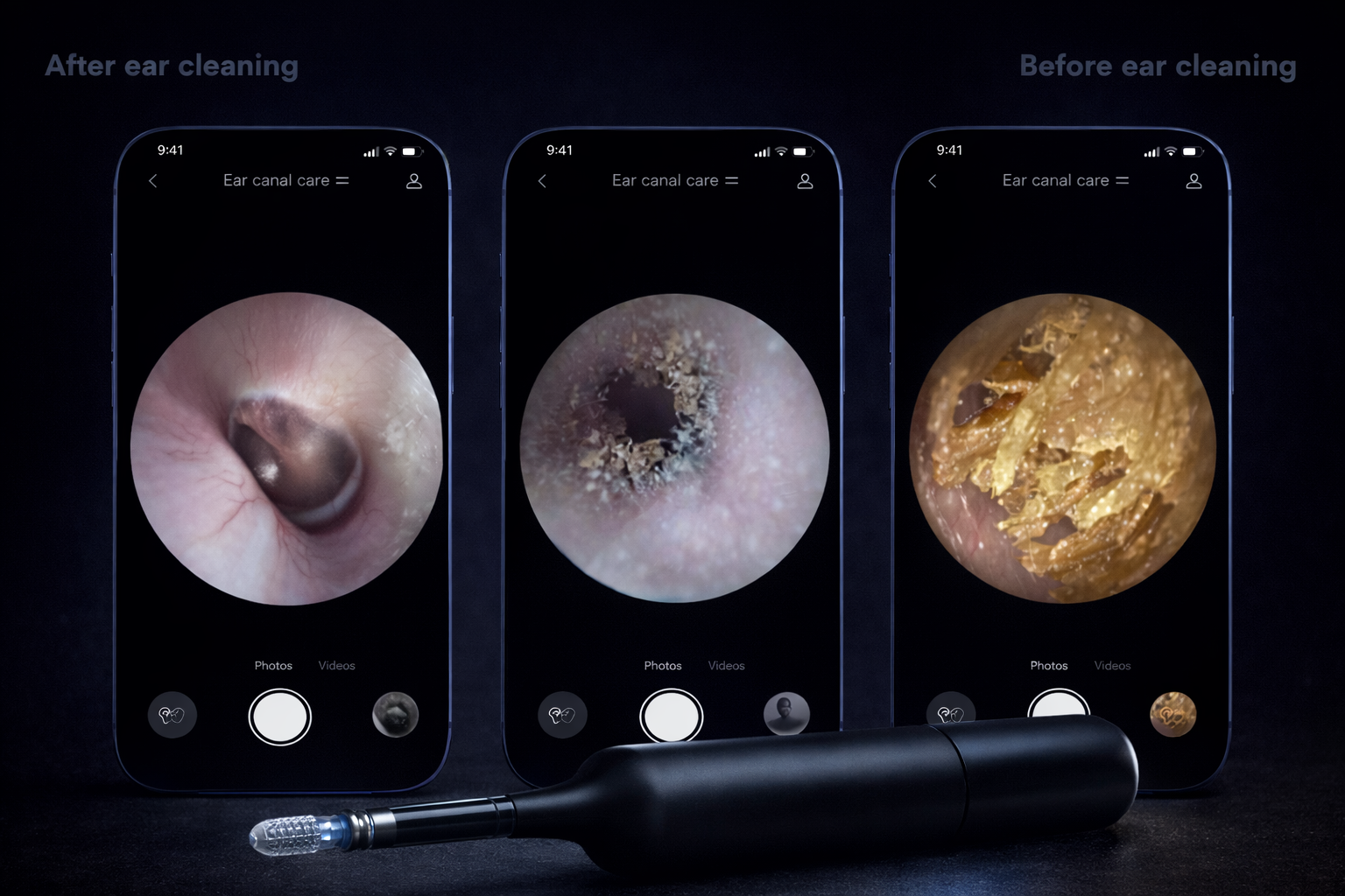 Before and after ear cleaning comparison